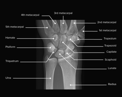 Articula O Do Punho Concise Medical Knowledge