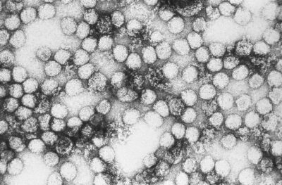 Yellow fever virus particles