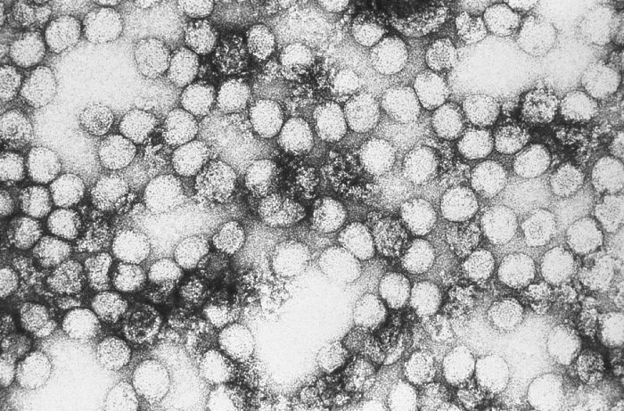 Partículas do vírus da febre amarela