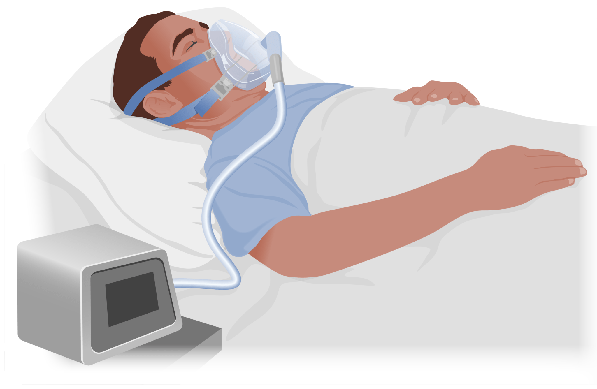 Obstructive Sleep Apnea | Concise Medical Knowledge