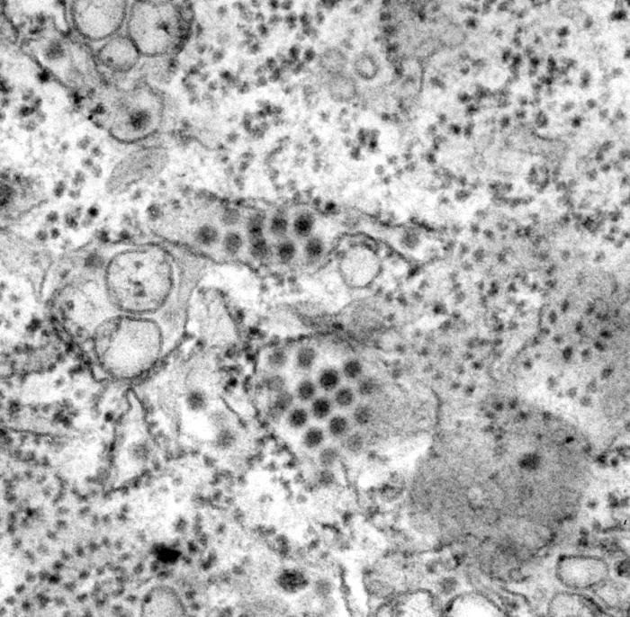 Partículas del virus de la fiebre del dengue flaviviridae