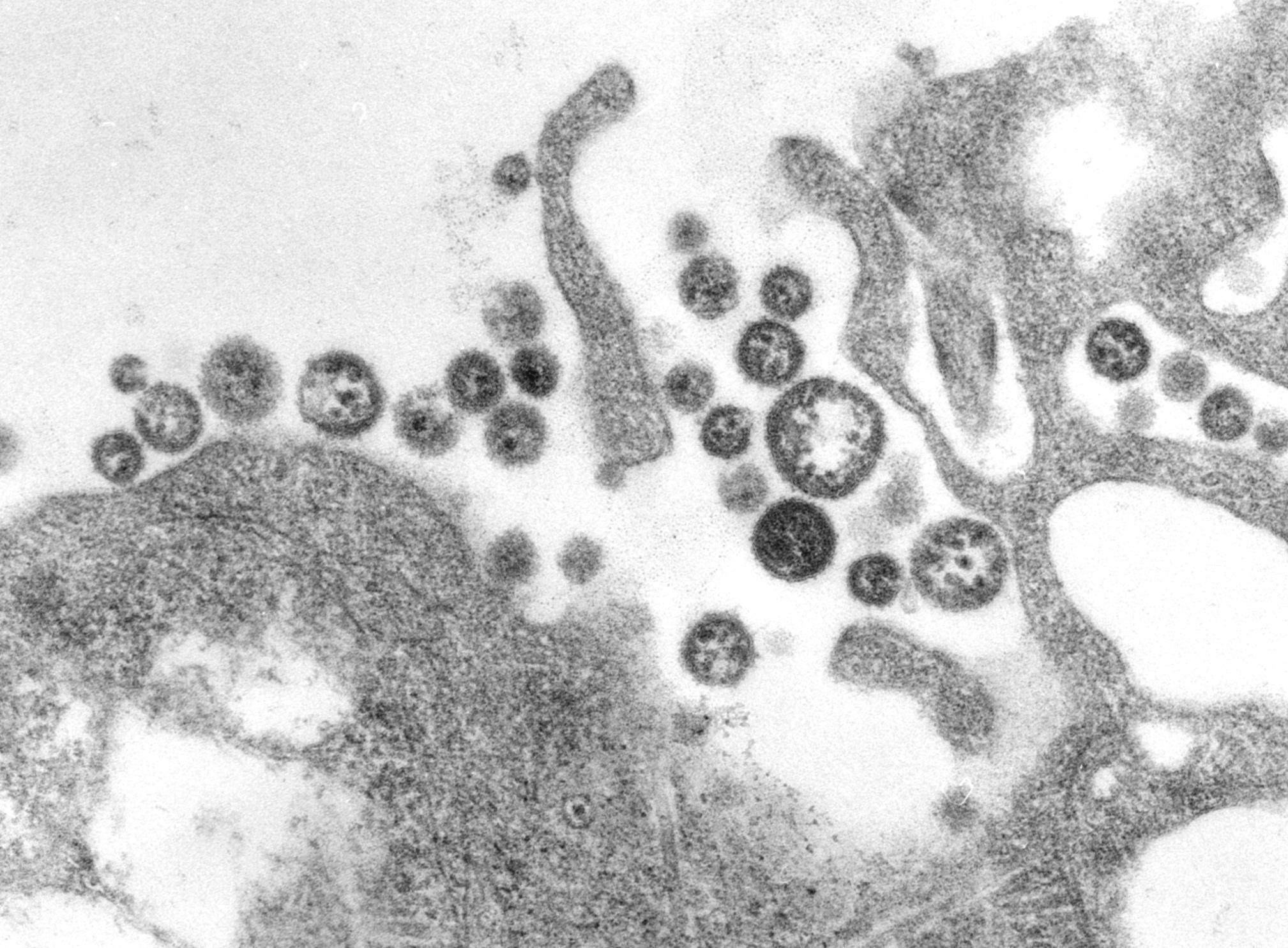 Electron micrograph of lassa virus virions