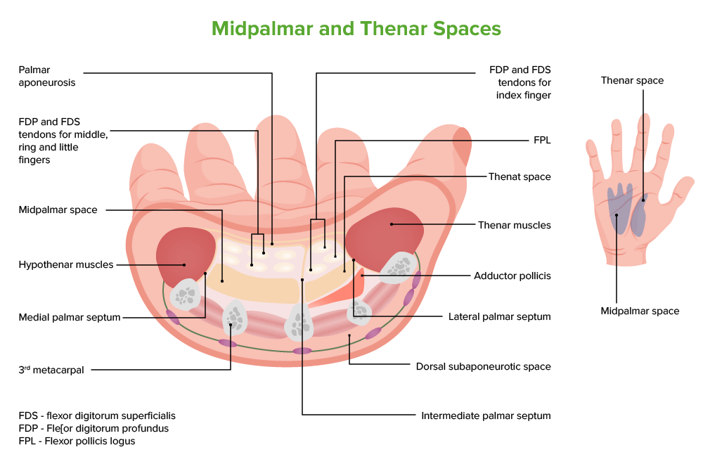 Midpalmar and thenar spaces