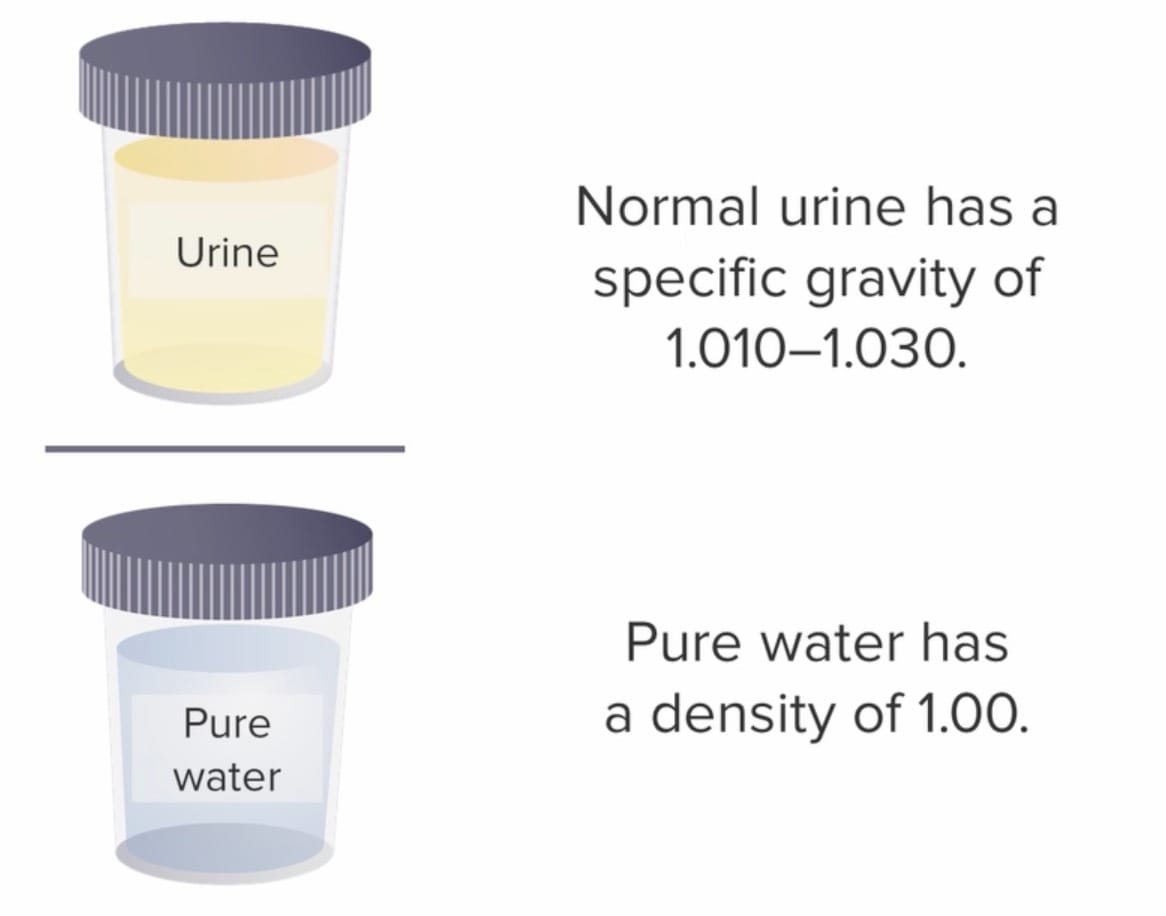 Two cups showing the density of normal urine (1.010-1.030) and pure water (1.00)