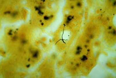 Liver tissue specimen stained leptospira sp. Bacteria.