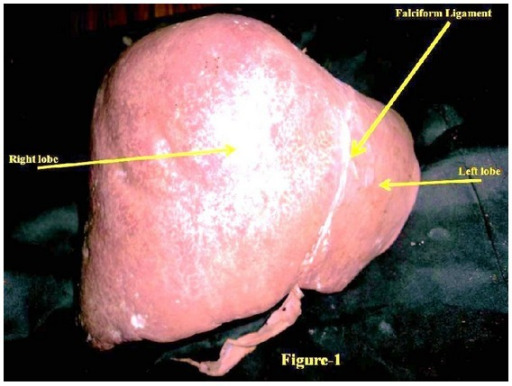 Anterosuperior view of liver