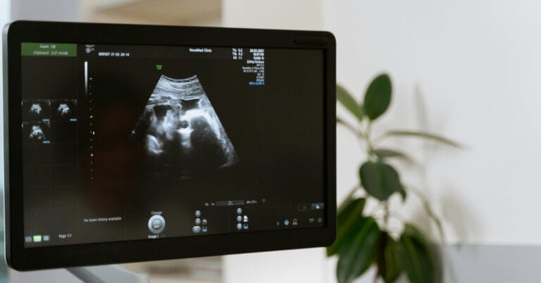 Screen showing fetal ultrasound