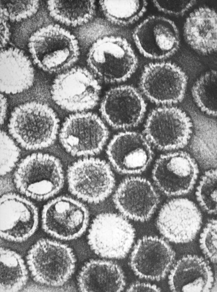 Negative-stained transmission electron microscopic image herpes simplex virions