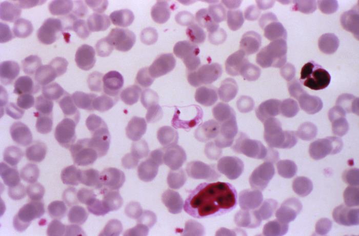 Photomicrograph trypanosoma cruzi chagas disease