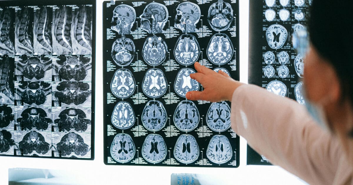 Radiology course blog banner Doctor pointing at x-ray photos