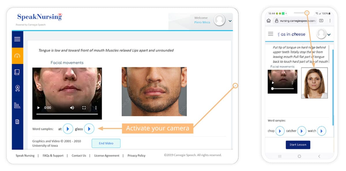 Speaknursing facial movements Speaknursing facial movements