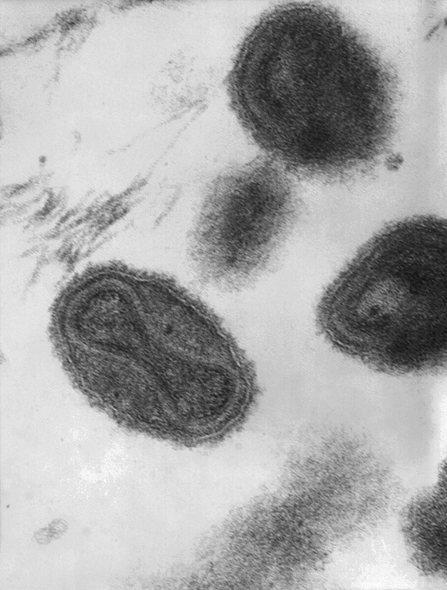 Transmission electron micrograph smallpox_virus_virions