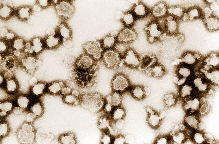 Morfologia ultraestrutural exibida por numerosos vírus la crosse bunyavirales